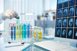 Hand reaching for vial with green fluid,monitor with x-rays in foreground Hand reaching for vial with green fluid,monitor with x-rays in foreground